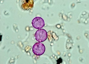 Microscópico polen de ciprés / Red Española de Aerobiología